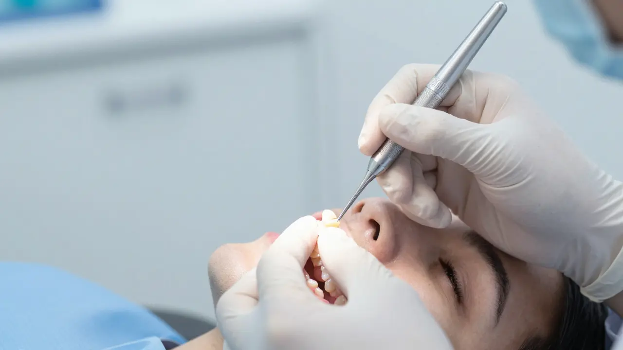 Kdy se dává mustek na zuby? Všechno, co potřebujete vědět