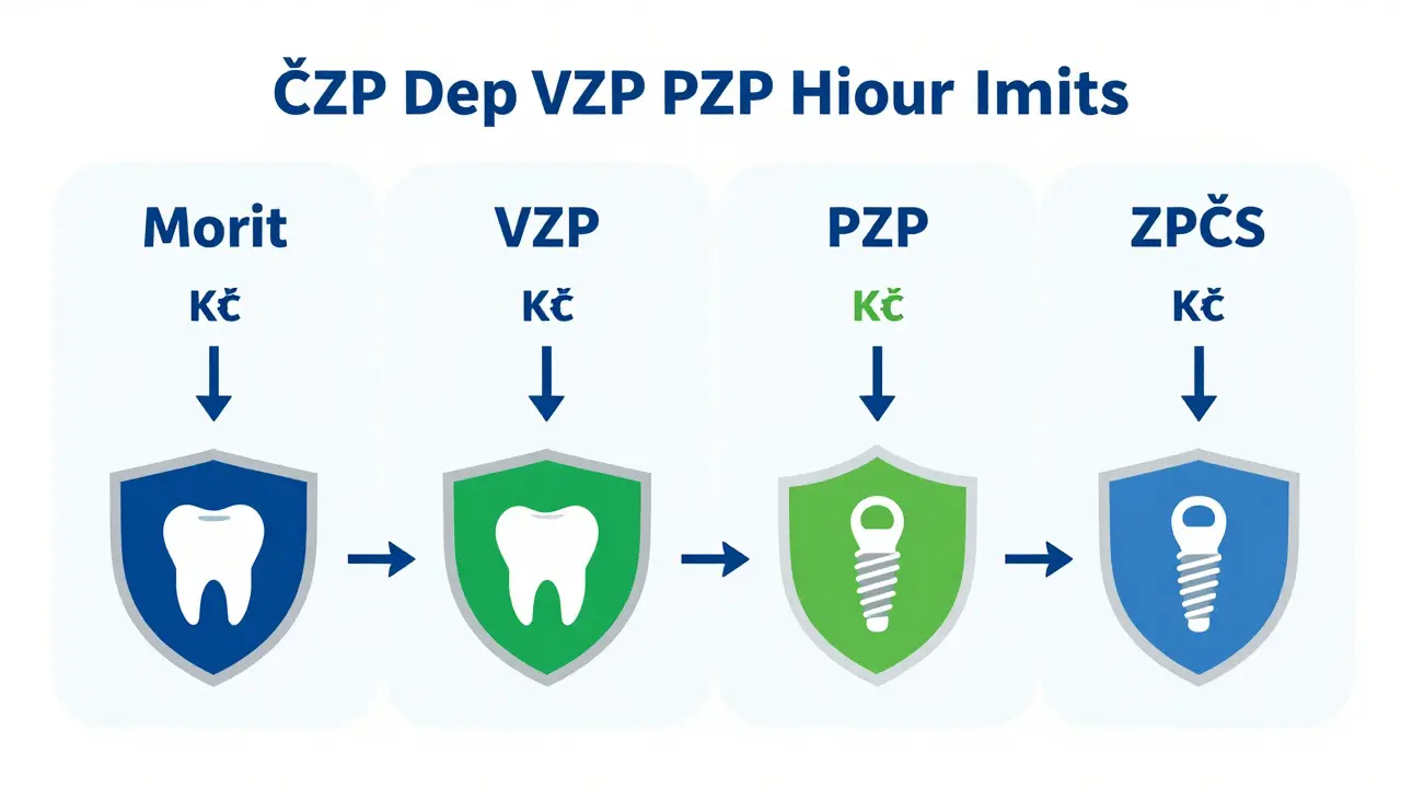 Srovnání příspěvků čtyř českých zdravotních pojišťoven na zubní léčbu.