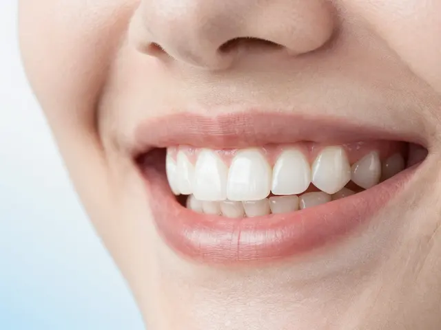 Bělení zubů: Kompletní průvodce metodami, cenami a bezpečností