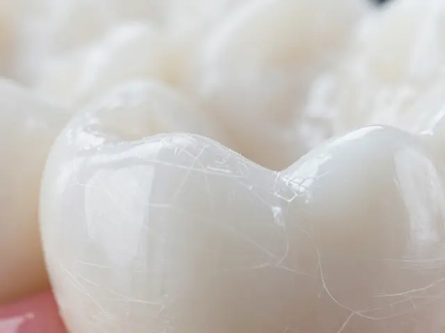 Praskliny na zubech: Jak je poznat, proč vznikají a jaké jsou možnosti léčby